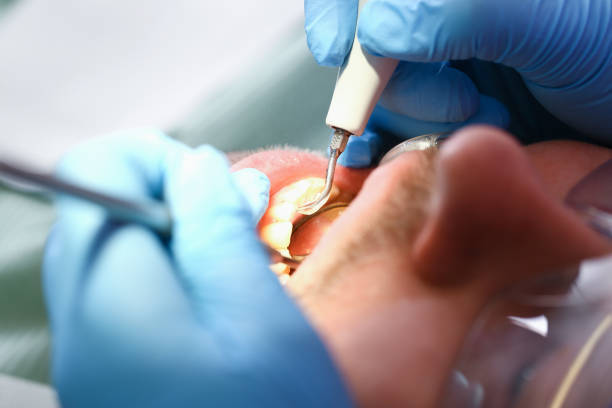 Best Tooth Pain Emergency Relief  in Grosse Pointe Woods, MI