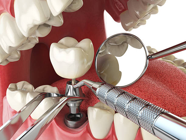 Best Broken Tooth Emergency  in Grosse Pointe Woods, MI